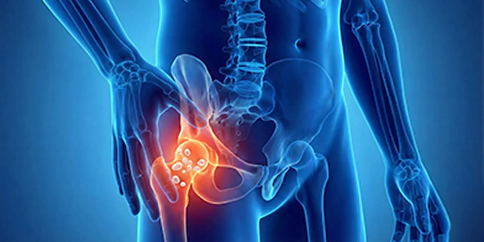 Sinovyal Kondromatozis Nedir? Belirtileri, Tanı ve Tedavisi